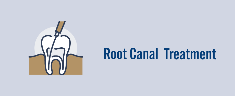 根管治療